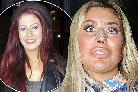 chloe ferry before surgery.